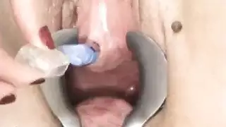 شرج منظف عرقي